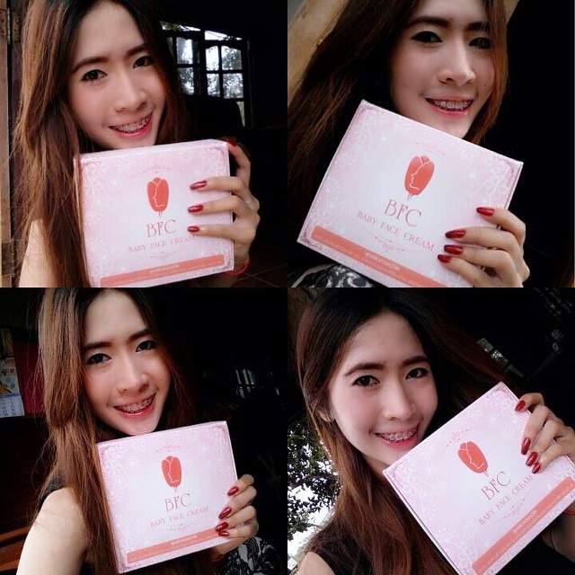ครีม BFC Baby Face Cream ครีมหน้าใสรักษาสิว