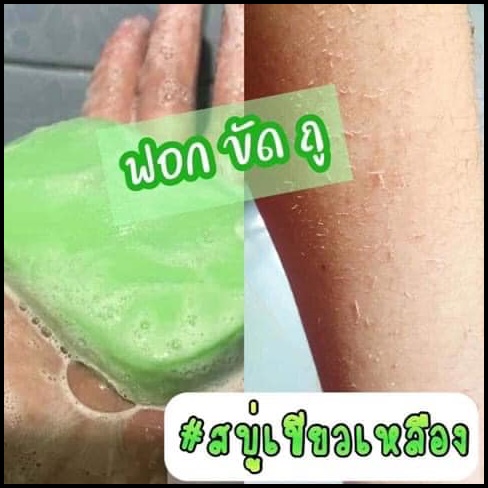 สบู่เขียว ระเบิดขี้ไคล Green Soap By Viewii ของแท้