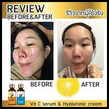 เซรั่มวิตามินซี Anti Aging Vitamin C Serum
