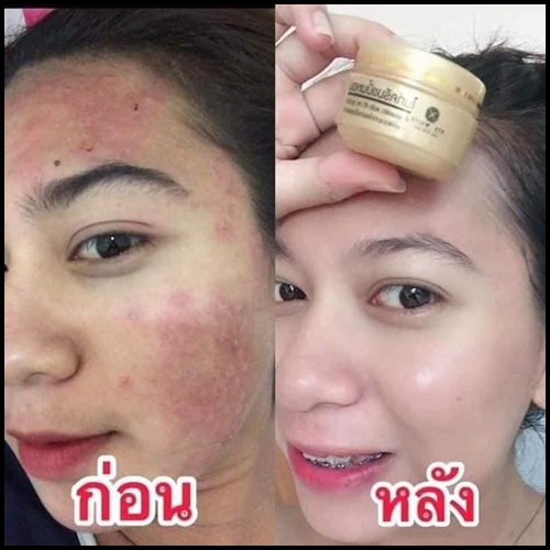 เอเต้ไวท์ ไนท์ครีมขมิ้นหอม Turmeric Night Cream ETE White