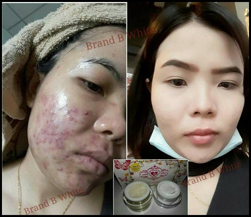 ครีมบีไวท์ ชุดไนท์ครีม B-White