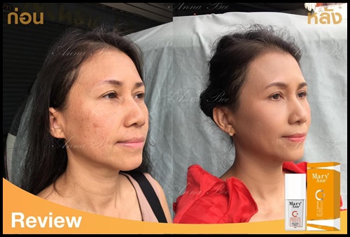 เซรั่มวิตซี สลายฝ้า มารีแอน Mary Ann (โปรส่งฟรี)