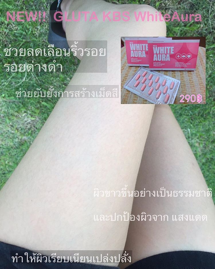 กลูต้าไวท์ออร่า (kbs by white aura)