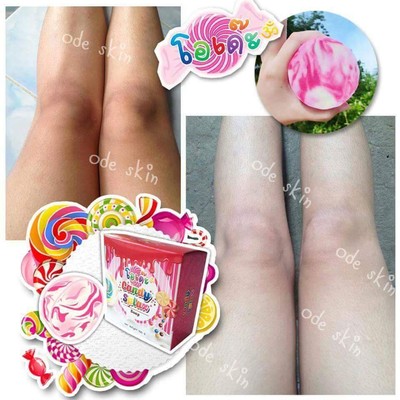 สบู่โอเด๊ะ (O'DE Candy Splaz)