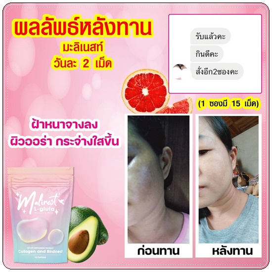 Malinest L-Gluta กลูต้าแม่น้ำหนึ่ง