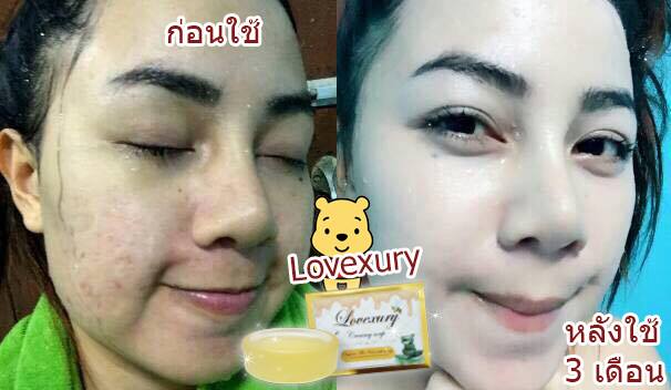 สบู่ครีมล้างหน้าเลิฟซูรี่ (Lovexury Creamy Soap) เกรดพรีเมี่ยม