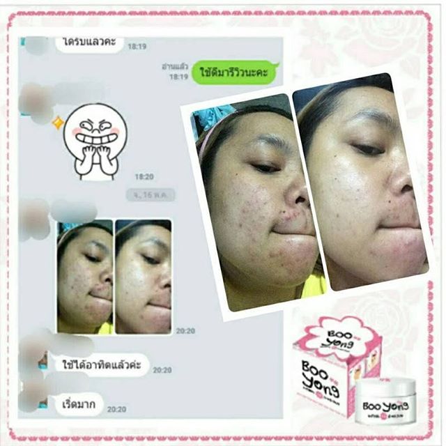 ครีมบูยอง (Boo Yong Whitening AA Flower Cream) ขาวใสใน3วัน