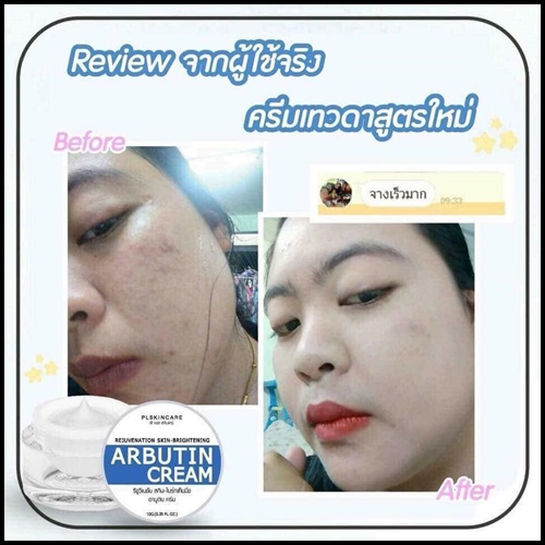 ครีมอาบูติน ครีมเทวดา สูตรใหม่ REJUVENATION SKIN-BRIGHTENING ARBUTIN CREAM