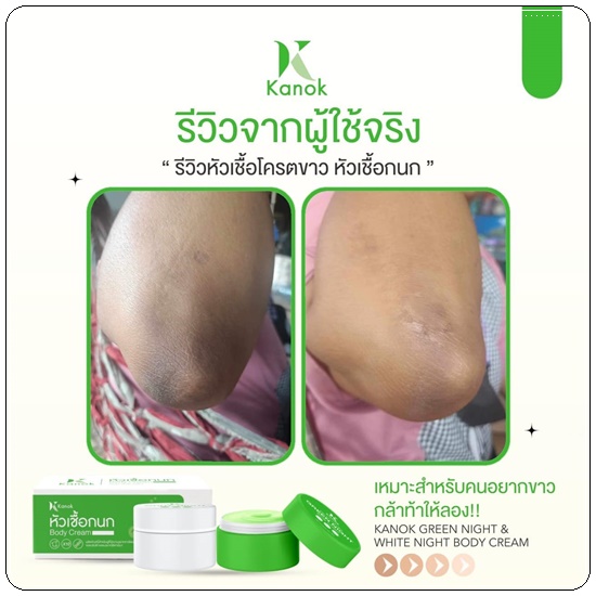 เซ็ตผิวขาว หัวเชื้อกนก Kanok Body Cream