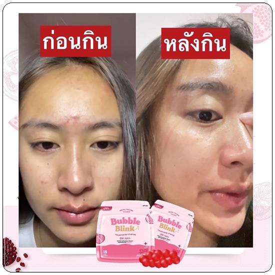 วิตามินแก้มใส Bubble Blink Yerpall (ของแท้)