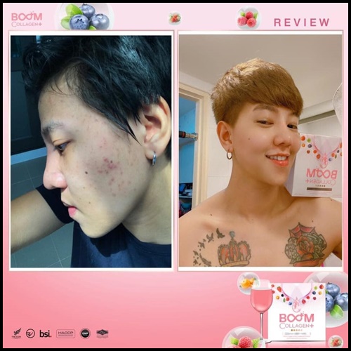 Boom Collagen+ บูม คอลลาเจน พลัส