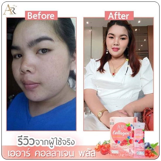 เออาร์ คอลลาเจน พลัส AR Collagen+