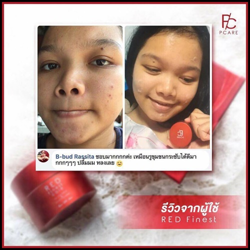 ครีมบำรุงเรด ไฟเนสต์ แคร์ Red Finest Care by Pcare Skincare