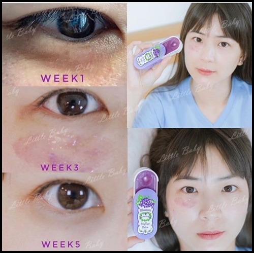 Blossom My Eye Balm Little Baby บาล์มบำรุงรอบดวงตา