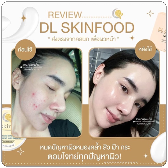 Deli Skin Night Cream ไนท์ครีมบำรุงผิวหน้า