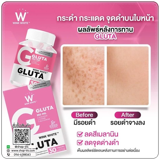 Gluta Wink White กลูต้าวิ้งไวท์ (1แถม1)