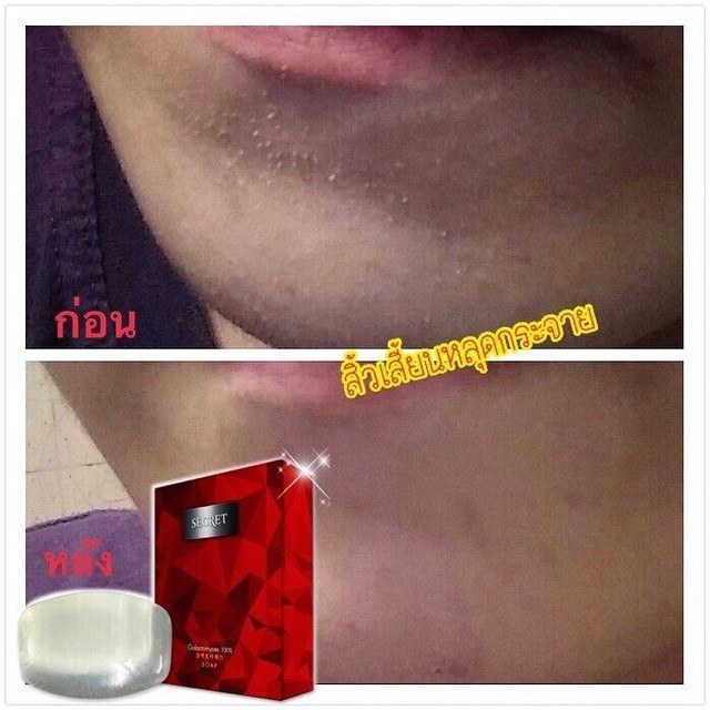 สบู่พิเทร่าหน้า Galactomyces soap by secret