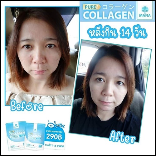 มานา เพียวคอลลาเจน Mana Pure Collagen Plus