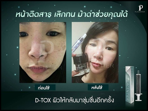 พลาเซนเทียร์ อัศวินม้าดำ PLACENTIER