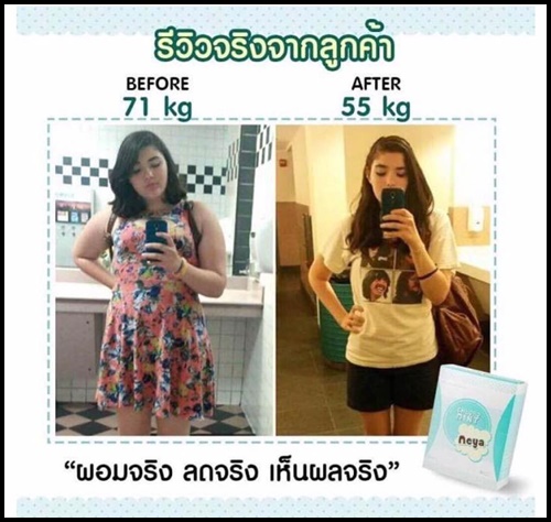 เมญ่า คลอโร มินท์ Meya Chloro Mint