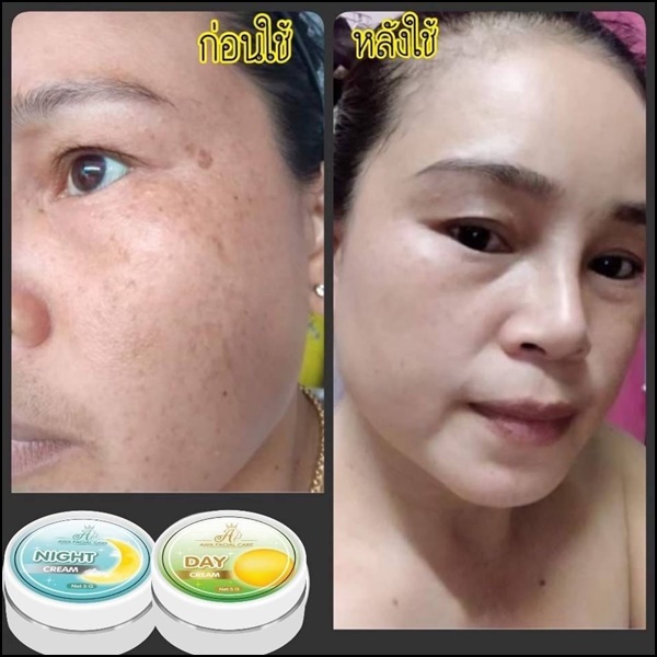 ครีมเอวา AWA Facial Care (ส่งฟรี)