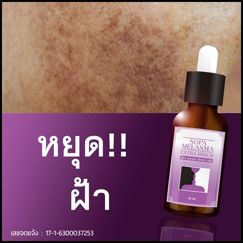เซรั่ม โสภา เมลาสม่า เอ็กซ์ตร้า Sopa Melasma Extra Serum เซรั่มสลายฝ้า