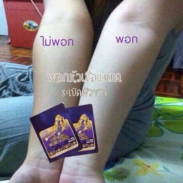 พอกหัวเชื้อแม่มด พอกระเบิดผิวขาว