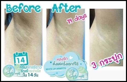 ครีมรักแร้ขาว ไวท์อัพอาร์มพิท White up armpits by Cherrlyn