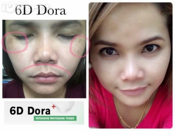 โทนเนอร์ 6D Dora สลายฝ้า กระ (6D Dora+ Intensive Whitening Toner 10 ml.)