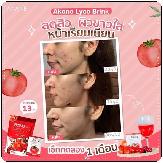 อากาเนะไลโคบริ้ง Akane Lyco Brink (ส่งฟรี)
