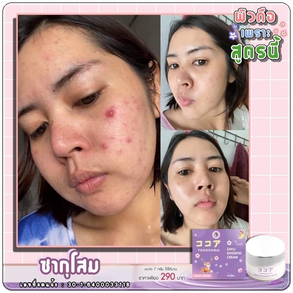 ซากุโสม Saku Ginseng Cream By Fondokmai