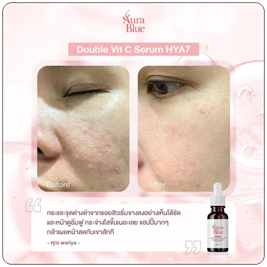 เซรั่มออร่าบลู Aura Blue Double Vitamin C Serum+HYA (ของแท้)