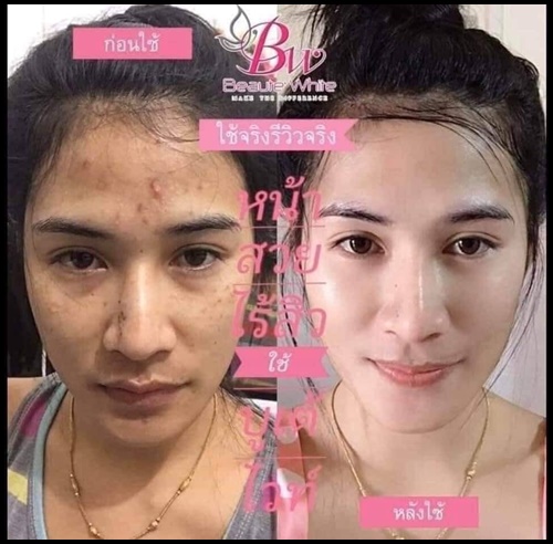 บูเต้ไวท์ เวชสำอางค์ BW Beaute White เซ็ตเล็ก