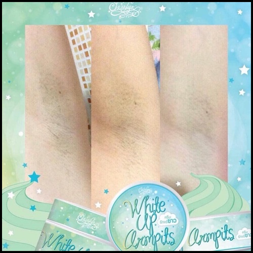 ครีมรักแร้ขาว ไวท์อัพอาร์มพิท White up armpits by Cherrlyn