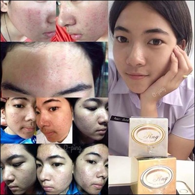 โอปิ้ง วิ้ง วินเนอร์ (O-Ping wink winner)