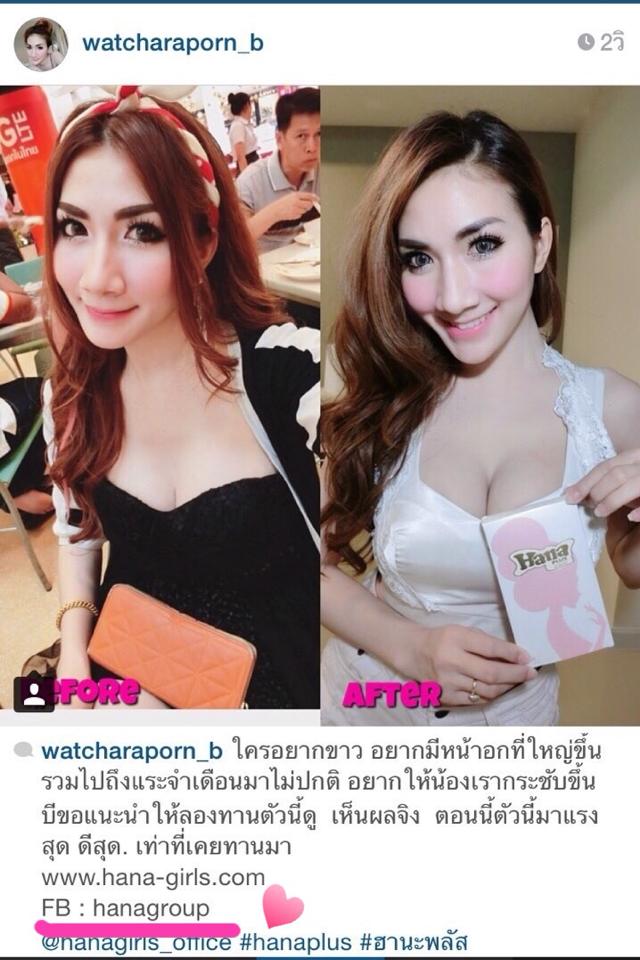 Hana Girl Plus อาหารเสริมสำหรับผู้หญิง