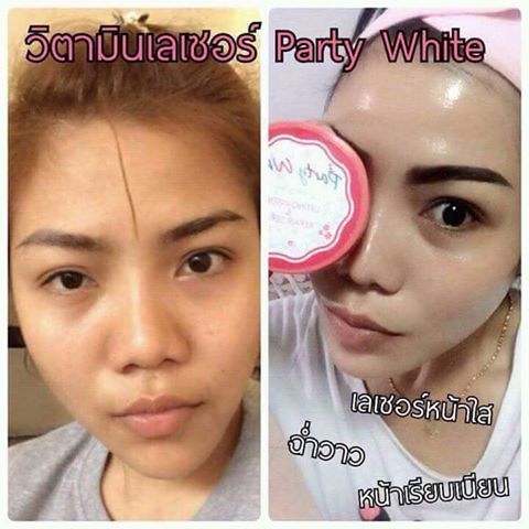 วิตามินเลเซอร์หน้าใส (lifting intense & repair serum By party white)