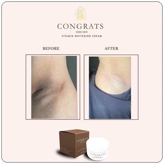 ครีมรักแร้ขาว Intensive Underarm Congrats Good Skin (แพ็คเก็จใหม่)