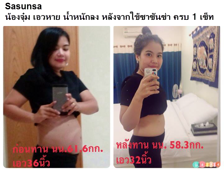 SASUNSA ซาซันซ่า ลดน้ำหนัก เซ็ตเดียวเอาอยู่