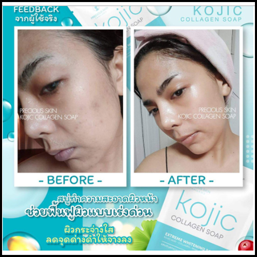 สบู่โคจิก คอลลาเจน โซป KOJIC Collagen soap