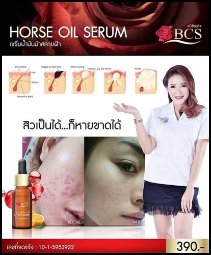 เซรั่มน้ำมันม้าสลายฝ้า Horse Oil Serum By BCS