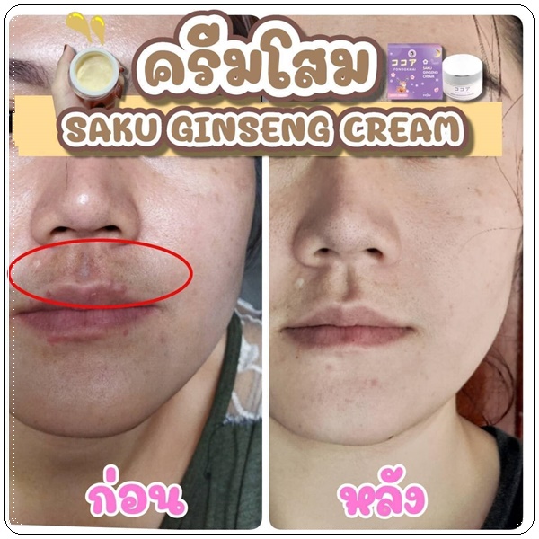 ซากุโสม Saku Ginseng Cream By Fondokmai