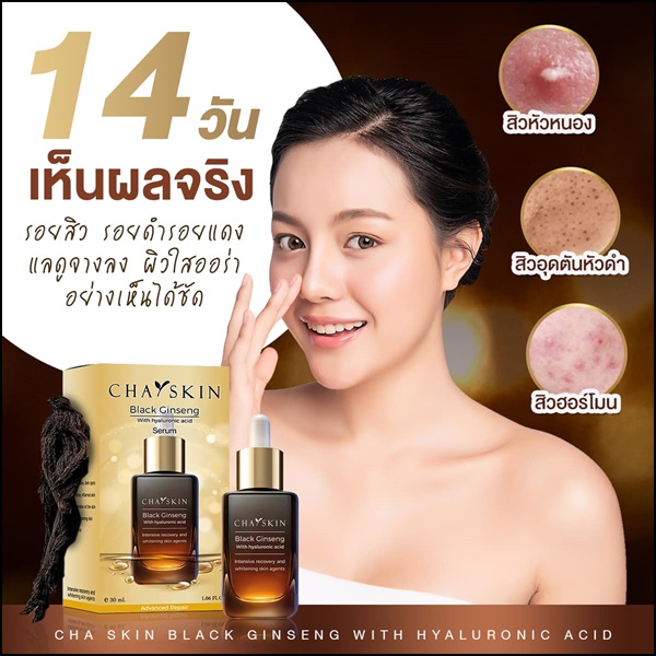 ชาสกิน เซรั่มสลายฝ้า CHASKIN Black Ginseng Serum (ส่งฟรี)