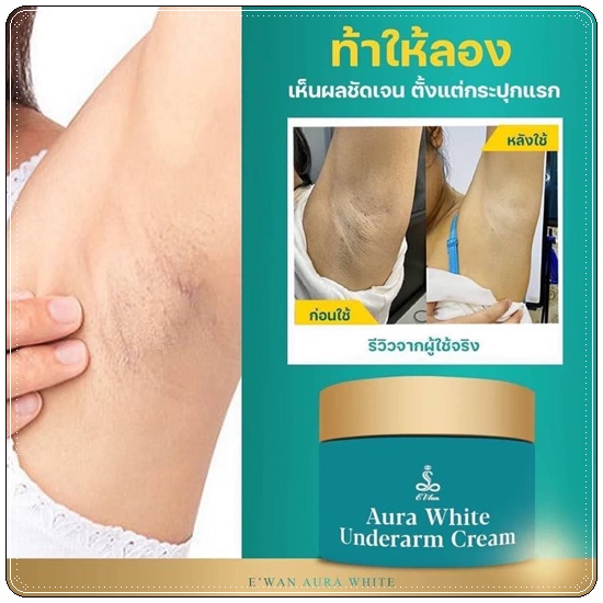 E wan ครีมบำรุงรักแร้ขาว Aura White Underarm Cream