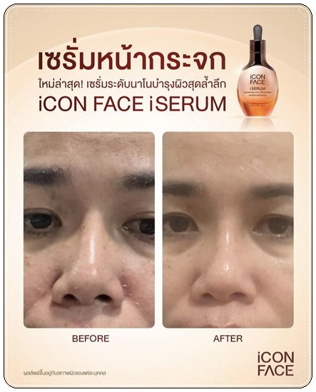 เซรั่มหน้ากระจก iCon Face iSerum เซรั่มมินพีชญา (ของแท้)