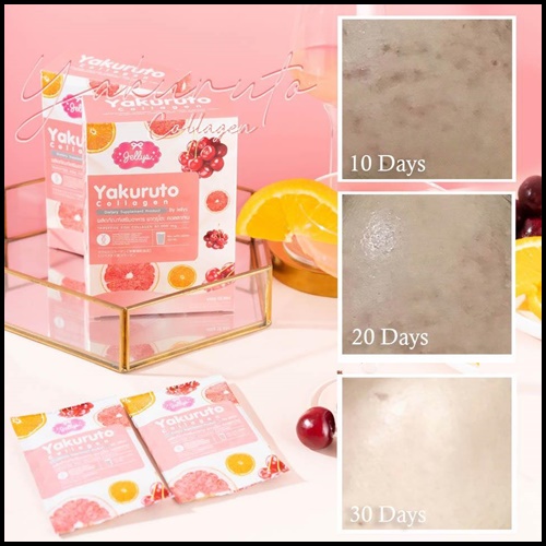 ยากุรุโตะ คอลลาเจน Yakuruto Collagen (โปรส่งฟรี)