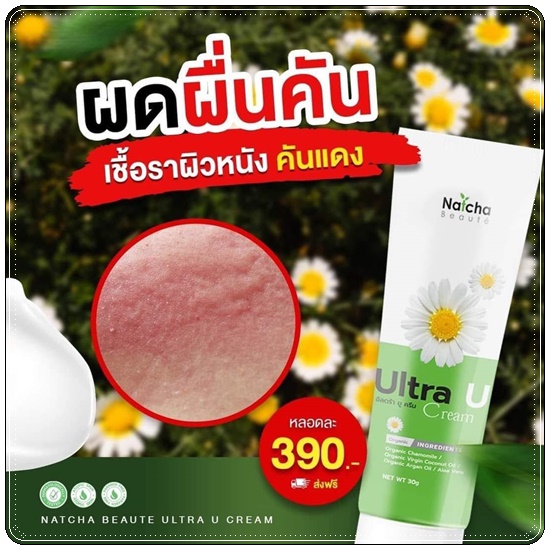 อัลตร้า ยู ครีม Ultra U Cream Natcha ลดอาการคัน กลากเกลื้อน