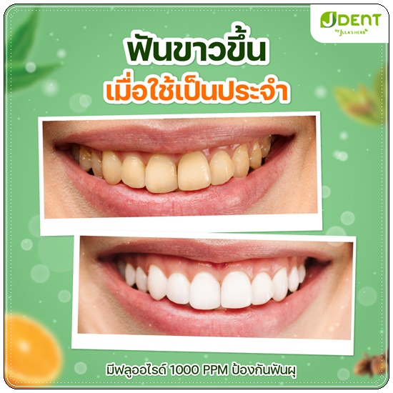 ยาสีฟันเจเด้นท์ JDent Herbal White Toothpaste