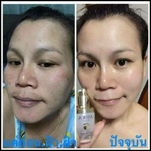 เซรั่มหน้าเด็ก ออร่าริช Aura Rich Bearberry White Booster Face