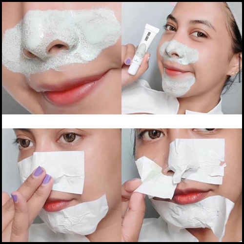 ครีมลอกสิวเสี้ยน ไลฟ์ลี่โนส Nakiz Lively Nose